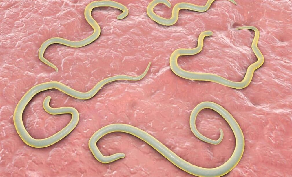Worms in the human body