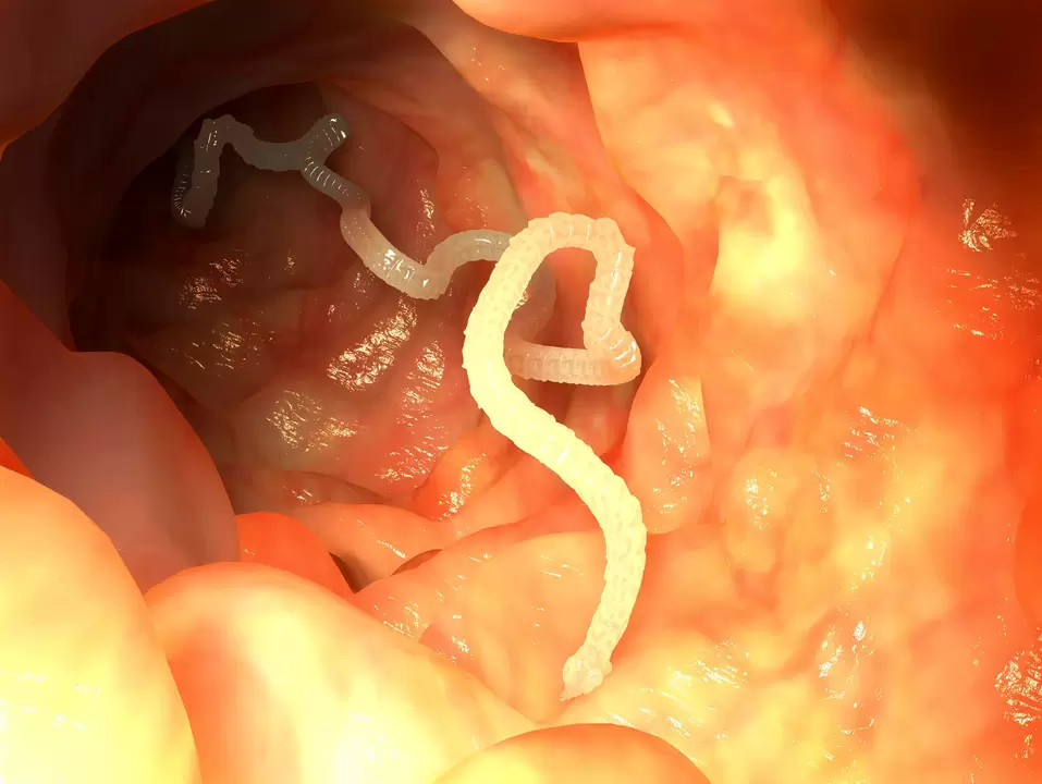 parasitic worm of the human esophagus
