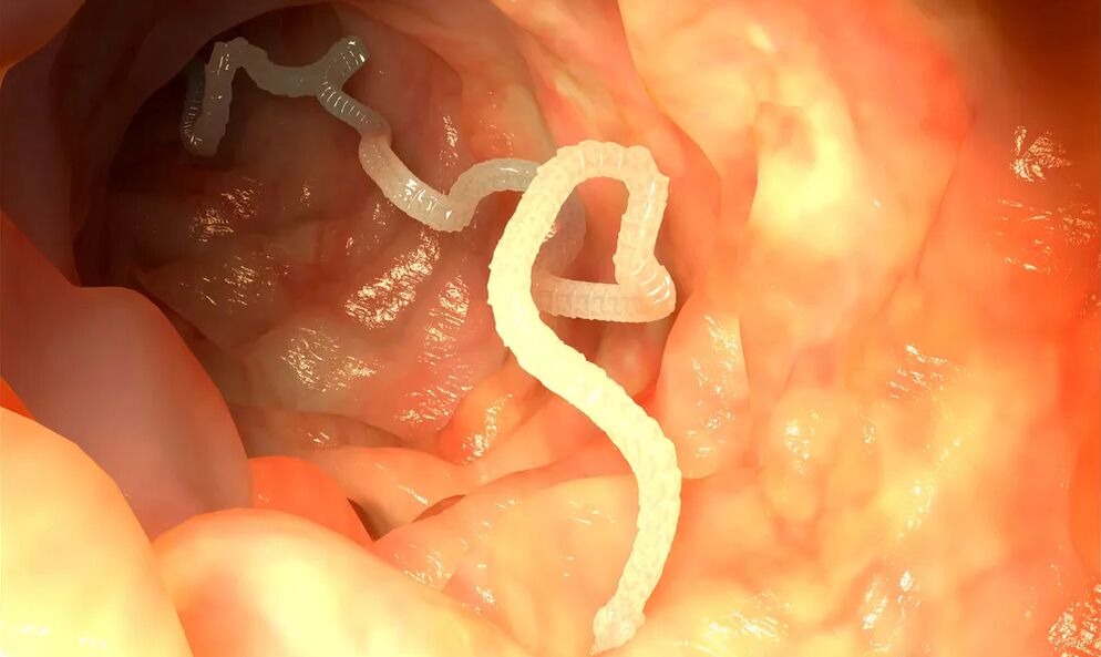 Luminal worms infect the intestines
