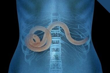 Parasites in the human body
