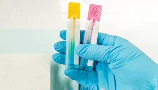 Parasitic diagnostic methods